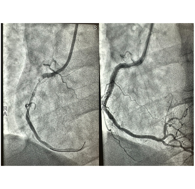 Advanced Cardiac Diagnostic Equipment at VCI