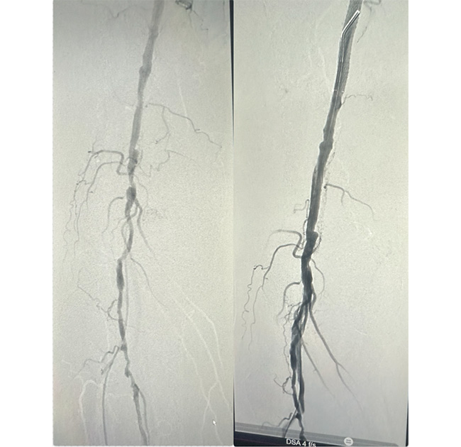 Interventional Cardiology Suite McKinney TX